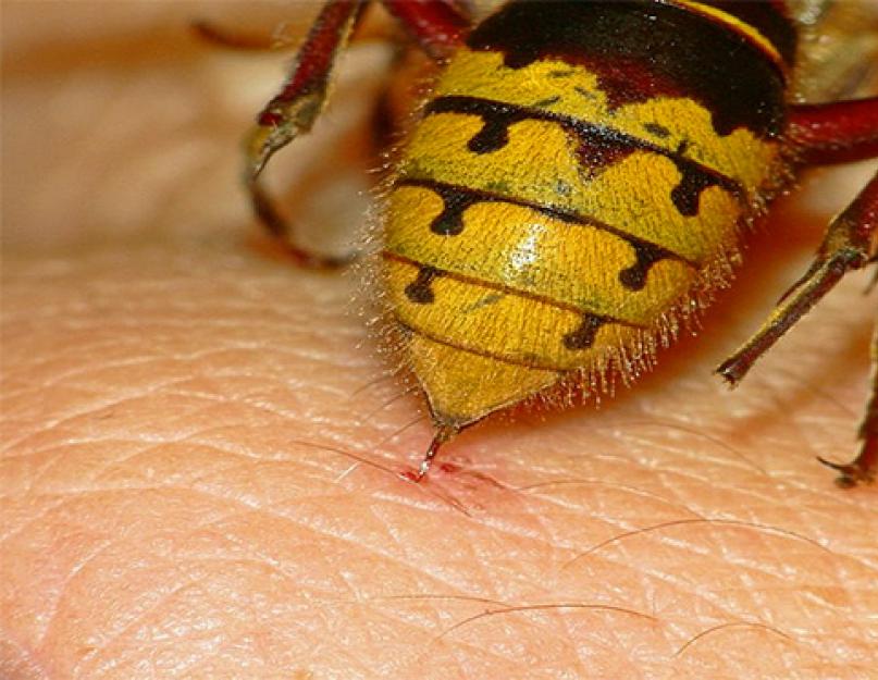Оказание 1 помощи при укусах насекомых. Оказание первой помощи при укусах насекомых: пчелы, осы, шершни, клещи