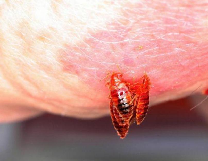 Два укуса рядом что за насекомое. Чем опасны укусы насекомых – опасные последствия и средства первой помощи