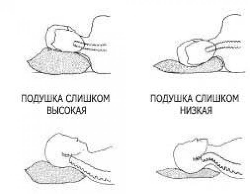 Как правильно класть ортопедическую подушку. Как правильно сделать подушку. Как класть ортопедическую подушку. Как правильно класть ортопедические подушки.картинки.