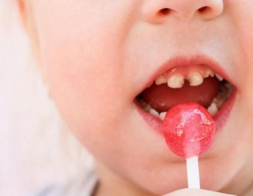 Что будет если ребенок ест много сладкого. Ребенок много ест сладкого – какие причины и как с этим бороться? Потому что это вкусно