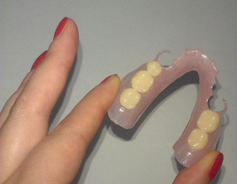 Плюсы и минусы гибких зубных протезов. Гибкие зубные протезы, что это такое и какова их характеристика? О недочетах мягких съемных протезов