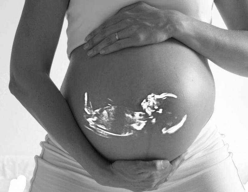 Маловодие 31. Причины, диагностика и лечение маловодия у беременных