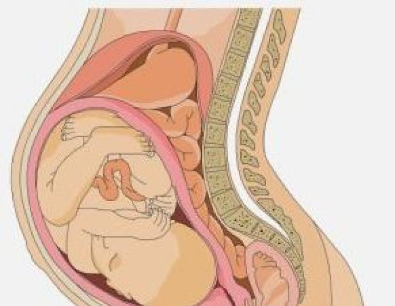 Беременность 40 недель 3 роды. Геморрой при беременности 3 триместр. Геморрой у беременной 2 триместр.
