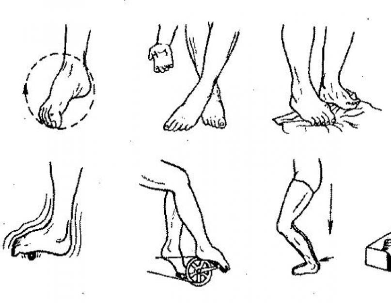 Отек колена после снятия гипса. Реабилитация после перелома ноги после снятия гипса