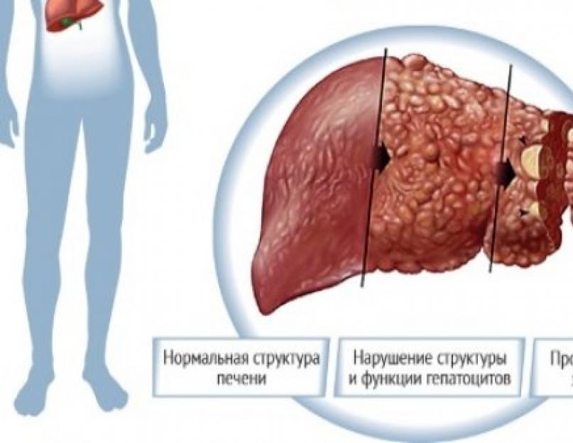 Нарушены функции печени