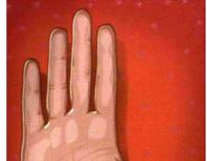 О чем говорят ваши ноги: палец Мортона, характер и генетика. Большой палец, хиромантия, его значение в характеристике человека Большой палец с талией и характер